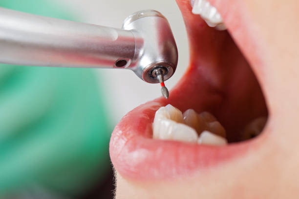 Best Emergency Dental Services for Seniors in Courtland, VA
